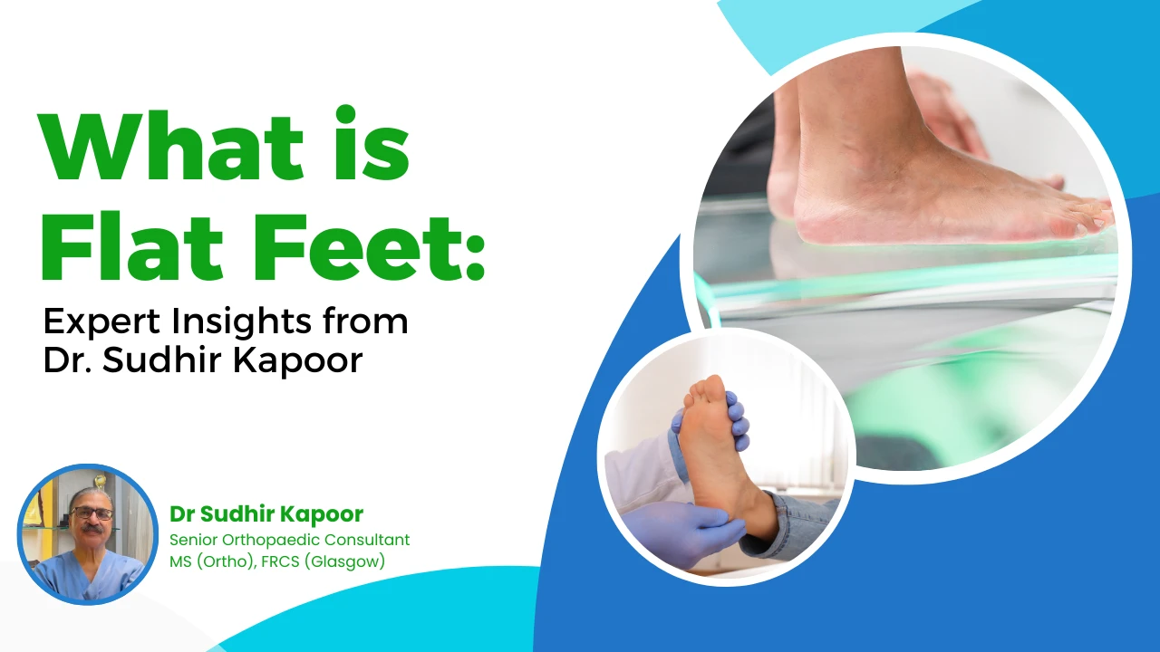 Flat Feet Treatment in Delhi