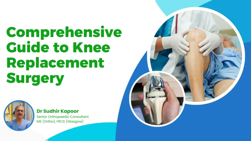 Knee Replacement Surgery Guide