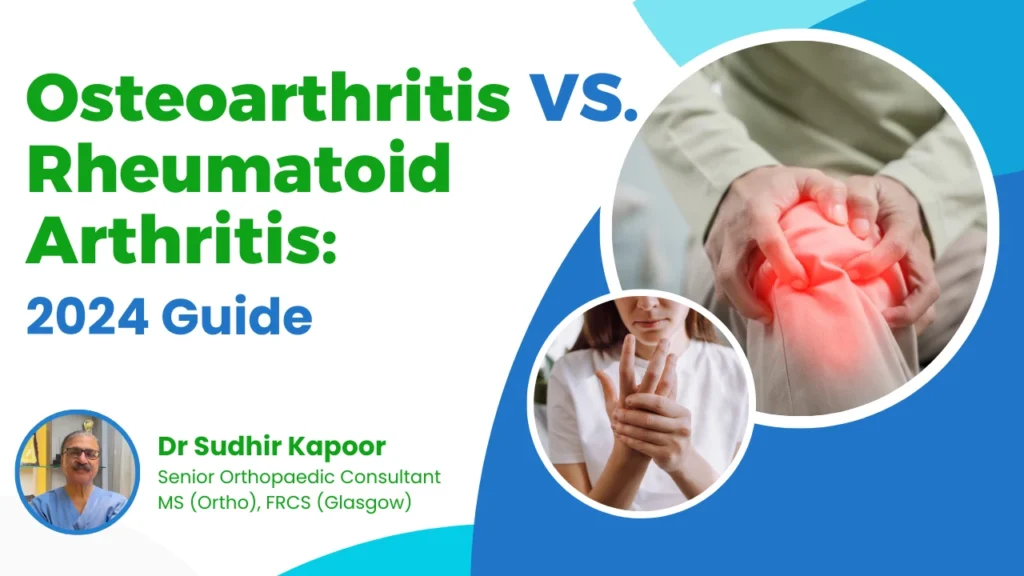 Osteoarthritis treatment in Delhi