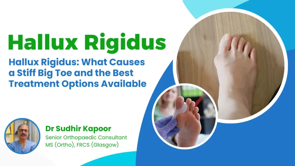 Hallux Rigidus treatment in Delhi