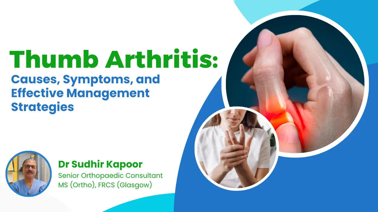 Thumb arthritis treatment in Delhi