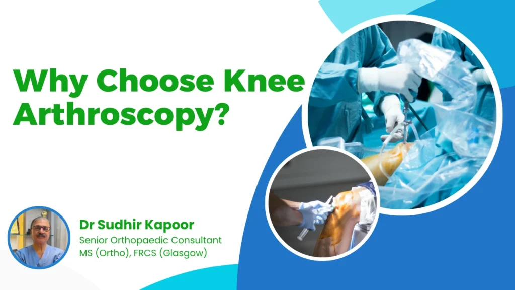 knee arthroscopy Delhi