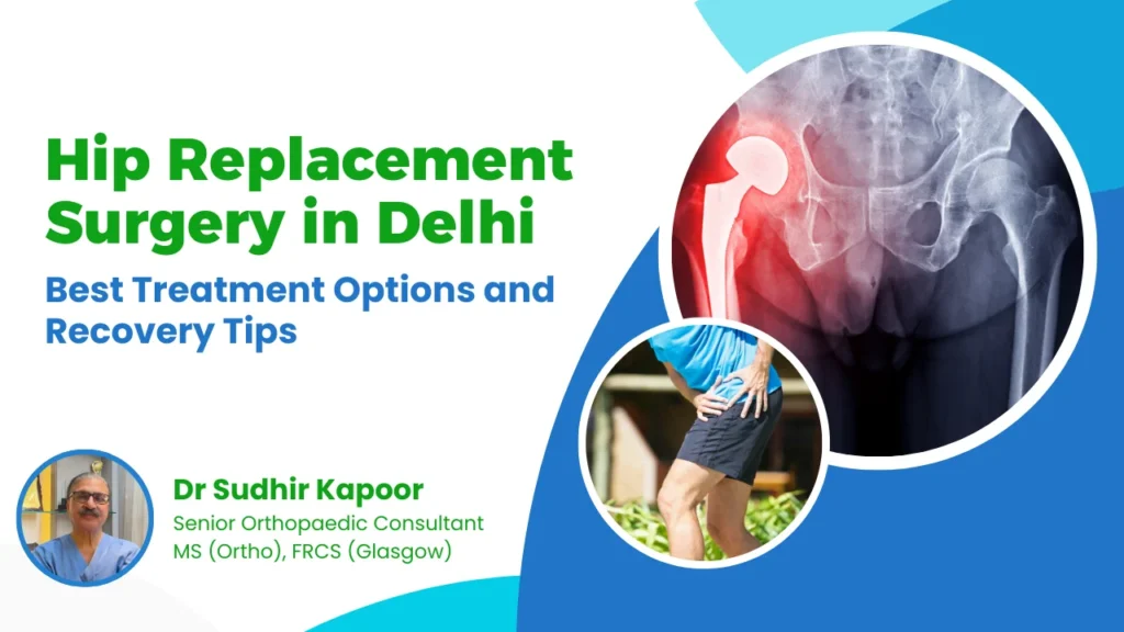 Hip Replacement Surgery in Delhi