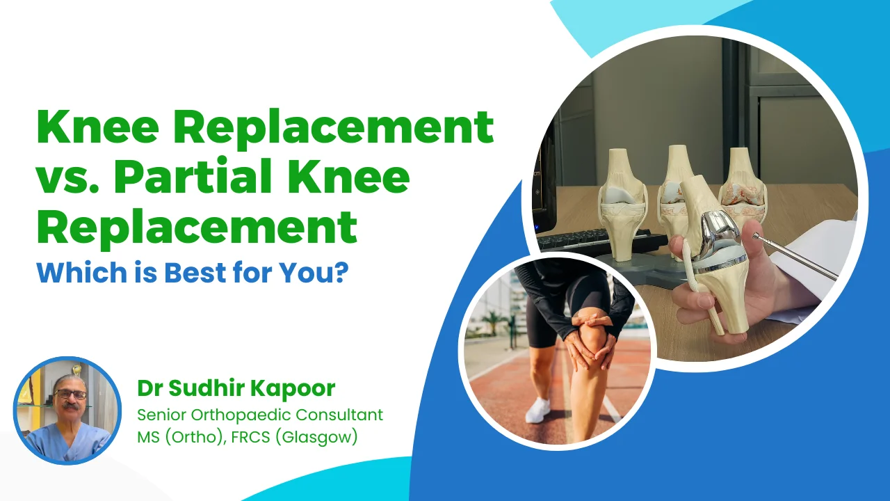 Knee replacement vs. partial knee replacement